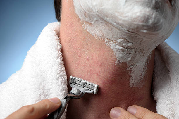 Close up of man shaving with razor and towel and razor burn and bumps