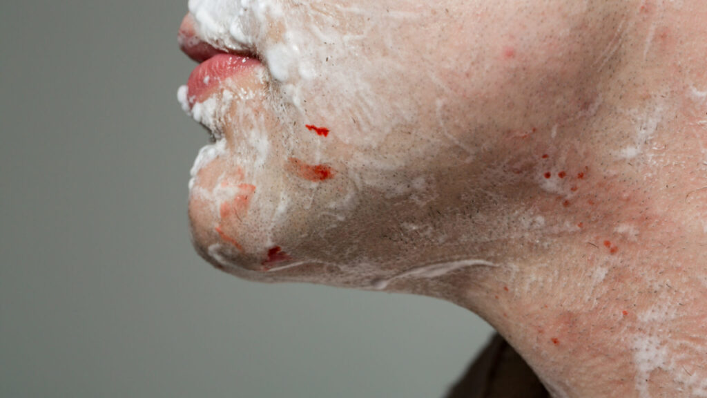 How to Treat a Cut After Shaving